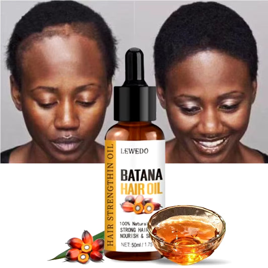 Naturals Batana Oil Fast Hair Growth for Men Women Pure Batana Oil Nourish Shiny Hair Healthy Hair Care anti Hair Loss