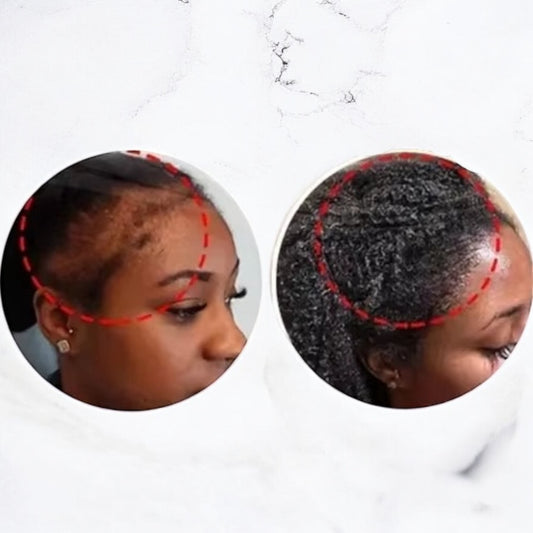 Shampoing solide bio au ricin